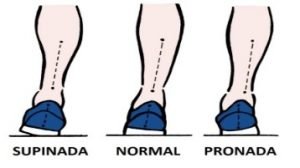 pisadas supinada normal pronada